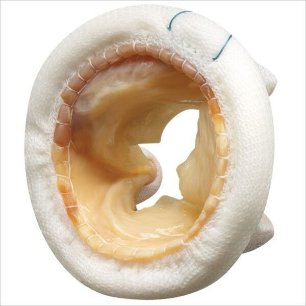 ARTIFICIAL HEART VALVE