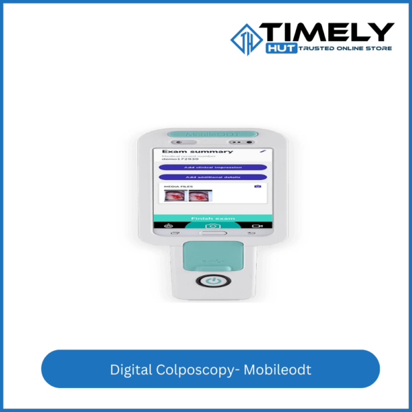 Digital Colposcopy- Mobileodt