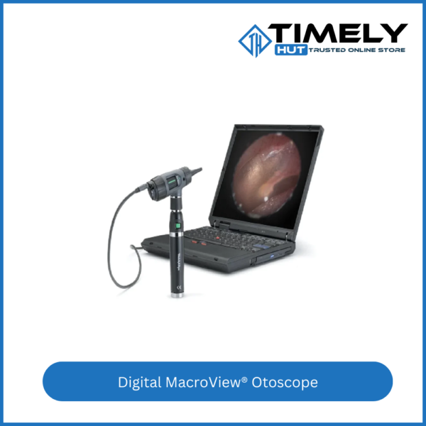 Digital MacroView® Otoscope Price in Bangladesh